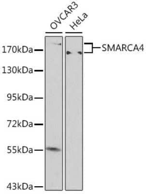 Western Blot: Brg1 Antibody [NBP2-92957] - Analysis of extracts of various cell lines, using Brg1 at 1:500 dilution. Secondary antibody: HRP Goat Anti-Rabbit IgG (H+L) at 1:10000 dilution. Lysates/proteins: 25ug per lane. Blocking buffer: 3% nonfat dry milk in TBST.