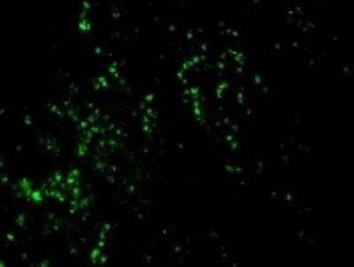 Immunohistochemistry-Paraffin: Bromodeoxyuridine/BrdU Antibody (BRD469) - Azide and BSA Free [NBP2-34565] - Formalin-fixed, paraffin-embedded Rat Kidney stained with AF488 conjugate of BrdU Monoclonal Antibody (BRD469).