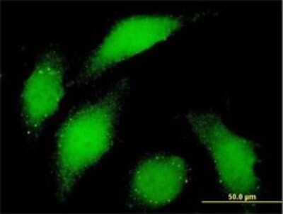 Immunocytochemistry/Immunofluorescence: Bub1 Antibody (4C3-4C9) [H00000699-M01] - Analysis of monoclonal antibody to BUB1 on HeLa cell . Antibody concentration 10 ug/ml.