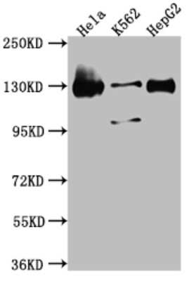 Western Blot: Bub1 Antibody (9C11) [NBP3-15170] - Positive WB detected in: Hela whole cell lysate, K562 whole cell lysate, HepG2 whole cell lysate. All lanes: Bub1 antibody at 1:1000. Secondary: Goat polyclonal to rabbit IgG at 1/50000 dilution. Predicted band size: 123, 116, 120 KDa. Observed band size: 130 KDa.