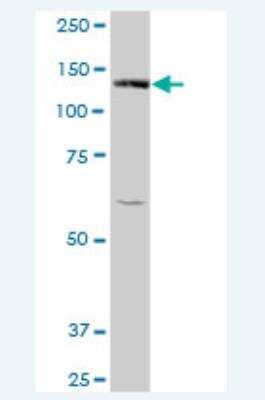 Western Blot: Bub1 Antibody [H00000699-B01P-50ug] - BUB1 MaxPab polyclonal antibody. Western Blot analysis of BUB1 expression in 293.