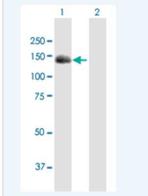 Western Blot: Bub1 Antibody [H00000699-B01P-50ug] - Analysis of BUB1 expression in transfected 293T cell line (H00000699-T01) by BUB1 MaxPab polyclonal antibody.  Lane1:BUB1 transfected lysate(119.35 KDa). Lane2:Non-transfected lysate.
