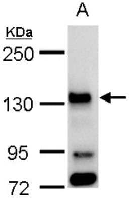 Western Blot: Bub1 Antibody [NBP1-31584] - A. 30 ug 293T whole cell lysate/extract 5 % SDS-PAGE BUB1 antibody  dilution: 1:1000