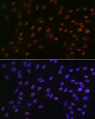 Immunocytochemistry/Immunofluorescence: Bub3 Antibody (10G1S6) [NBP3-16709] - Immunofluorescence analysis of C6 cells using Bub3 Rabbit mAb (NBP3-16709) at dilution of 1:100 (40x lens). Blue: DAPI for nuclear staining.