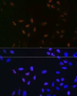 Immunocytochemistry/Immunofluorescence: Bub3 Antibody (10G1S6) [NBP3-16709] - Immunofluorescence analysis of U-2 OS cells using Bub3 Rabbit mAb (NBP3-16709) at dilution of 1:100 (40x lens). Blue: DAPI for nuclear staining.