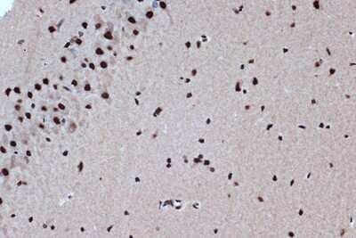 Immunohistochemistry-Paraffin: Bub3 Antibody (10G1S6) [NBP3-16709] - Immunohistochemistry of paraffin-embedded rat brain using Bub3 Rabbit mAb (NBP3-16709) at dilution of 1:100 (40x lens).Perform microwave antigen retrieval with 10 mM Tris/EDTA buffer pH 9.0 before commencing with IHC staining protocol.