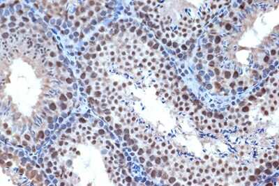 Immunohistochemistry-Paraffin: Bub3 Antibody (10G1S6) [NBP3-16709] - Immunohistochemistry of paraffin-embedded mouse testis using Bub3 Rabbit mAb (NBP3-16709) at dilution of 1:100 (40x lens).Perform microwave antigen retrieval with 10 mM Tris/EDTA buffer pH 9.0 before commencing with IHC staining protocol.