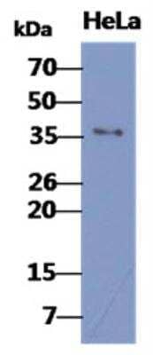 Western Blot: Bub3 Antibody (2H6) [NBP2-42680] - The cell lysates of HeLa (40ug) were resolved by SDS-PAGE, transferred to PVDF membrane and probed with anti-human BUB3 antibody (1:1000). Proteins were visualized using a goat anti-mouse secondary antibody conjugated to HRP and an ECL detection system.