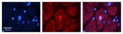 Immunohistochemistry: Bub3 Antibody [NBP1-58206] - Formalin Fixed Paraffin Embedded Tissue: Human heart Tissue Observed Staining: Nucleus Primary Antibody Concentration: 1:100 Other Working Concentrations: N/A Secondary Antibody: Donkey anti-Rabbit-Cy3 Secondary Antibody Concentration: 1:200 Magnification: 20X Exposure Time: 0.5 - 2.0 sec