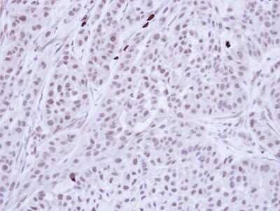 Immunohistochemistry-Paraffin: Bub3 Antibody [NBP1-33558] - Paraffin-embedded A549 Xenograft, using antibody at 1:100 dilution.