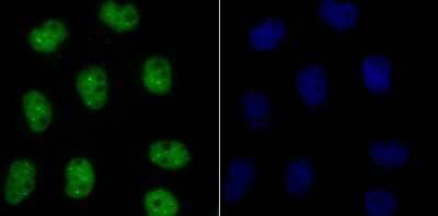 Immunocytochemistry/Immunofluorescence: Bub3 Antibody (JG38-81) [NBP2-75424] - Staining Bub3 in A431 cells (green). The nuclear counter stain is DAPI (blue). Cells were fixed in paraformaldehyde, permeabilised with 0.25% Triton X100/PBS.