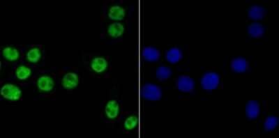 Immunocytochemistry/Immunofluorescence: Bub3 Antibody (JG38-81) [NBP2-75424] - Staining Bub3 in LOVO cells (green). The nuclear counter stain is DAPI (blue). Cells were fixed in paraformaldehyde, permeabilised with 0.25% Triton X100/PBS.