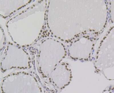 Immunohistochemistry-Paraffin: Bub3 Antibody (JG38-81) [NBP2-75424] - Analysis of paraffin-embedded human thyroid gland tissue using anti-Bub3 antibody. Counter stained with hematoxylin.
