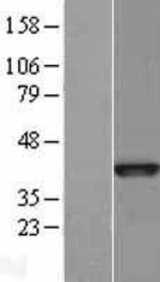 Western Blot: Bub3 Overexpression Lysate (Adult Normal) [NBL1-08058] Left-Empty vector transfected control cell lysate (HEK293 cell lysate); Right -Over-expression Lysate for Bub3.