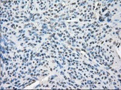 Immunohistochemistry: BubR1 Antibody (OTI6E5) - Azide and BSA Free [NBP2-70314] - Staining of paraffin-embedded endometrium tissue using anti-BubR1 mouse monoclonal antibody.