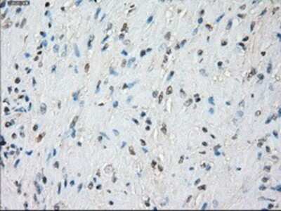 Immunohistochemistry: BubR1 Antibody (OTI6E5) - Azide and BSA Free [NBP2-70314] - Staining of paraffin-embedded prostate tissue using anti-BubR1 mouse monoclonal antibody.