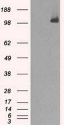 Western Blot: BubR1 Antibody (OTI6E5) - Azide and BSA Free [NBP2-70314] - HEK293T cells were transfected with the pCMV6-ENTRY control (Left lane) or pCMV6-ENTRY BubR1 (Right lane) cDNA for 48 hrs and lysed. Equivalent amounts of cell lysates (5 ug per lane) were separated by SDS-PAGE and immunoblotted with anti-BubR1.