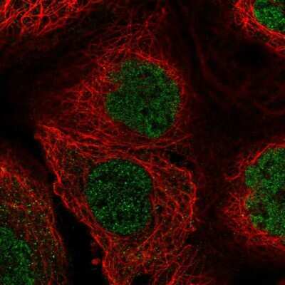 Immunocytochemistry/ Immunofluorescence Buster3 Antibody - BSA Free