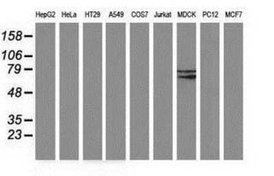 Western Blot: Butyrylcholinesterase/BCHE Antibody (OTI1E1) [NBP2-03523] - Analysis of extracts (35ug) from 9 different cell lines by using anti-Butyrylcholinesterase monoclonal antibody (HepG2: human; HeLa: human; SVT2: mouse; A549: human; COS7: monkey; Jurkat: human; MDCK: canine; PC12: rat; MCF7: human).