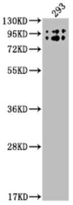 Western Blot: Butyrylcholinesterase/BCHE Antibody (1E9) [NBP3-15164] - Positive WB detected in: 293 whole cell lysate. All lanes: Butyrylcholinesterase/BCHE antibody at 1:2000. Secondary: Goat polyclonal to rabbit IgG at 1/50000 dilution. Predicted band size: 69 KDa. Observed band size: 90 KDa.