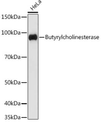 Western Blot: Butyrylcholinesterase/BCHE Antibody (4N2N9) [NBP3-16712] - Western blot analysis of extracts of HeLa cells, using Butyrylcholinesterase/BCHE antibody (NBP3-16712) at 1:1000 dilution. Secondary antibody: HRP Goat Anti-Rabbit IgG (H+L) at 1:10000 dilution. Lysates/proteins: 25ug per lane. Blocking buffer: 3% nonfat dry milk in TBST. Detection: ECL Basic Kit. Exposure time: 60s.