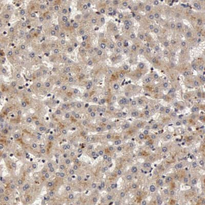 Immunohistochemistry-Paraffin: Butyrylcholinesterase/BCHE Antibody [NBP1-85633] - Staining of human liver shows cytoplasmic positivity in hepatocytes.