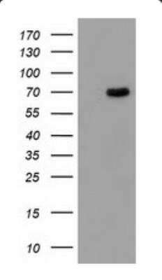 Western Blot: Butyrylcholinesterase/BCHE Antibody (OTI1E1) [NBP2-66381] - HEK293T cells were transfected with the pCMV6-ENTRY control (Left lane) or pCMV6-ENTRY BCHE (Right lane) cDNA for 48 hrs and lysed. Equivalent amounts of cell lysates (5 ug per lane) were separated by SDS-PAGE and immunoblotted with anti-BCHE.