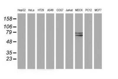 Western Blot: Butyrylcholinesterase/BCHE Antibody (OTI1E1) [NBP2-66381] - Analysis of extracts (35ug) from 9 different cell lines by using anti-BCHE monoclonal antibody (HepG2: human; HeLa: human; SVT2: mouse; A549: human; COS7: monkey; Jurkat: human; MDCK: canine; PC12: rat; MCF7: human).