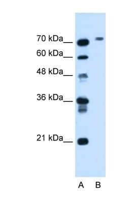 Western Blot: Butyrylcholinesterase/BCHE Antibody [NBP1-69541] - This Anti-BCHE antibody was used in Western Blot of HepG2 tissue lysate at a concentration of 1.25ug/ml.