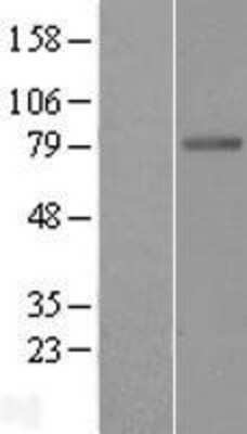 Western Blot: Butyrylcholinesterase/BCHE Overexpression Lysate [NBL1-07942] - Left-Empty vector transfected control cell lysate (HEK293 cell lysate); Right -Over-expression Lysate for Butyrylcholinesterase.