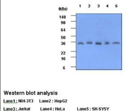 Western Blot: C-Reactive Protein/CRP Antibody (5A9) [NBP1-04282] - C-Reactive Protein Antibody (5A9) Cell lysates of NIH-3T3, HepG2, Jurkat, HeLa and SH-SY5Y (each 40ug) were resolved by SDS-PAGE, transferred to PVDF membrane and probed with anti-human CRP (1:1000). Proteins were visualized using a goat anti-mouse secondary antibody conjugated to HRP and an ECL detection system.