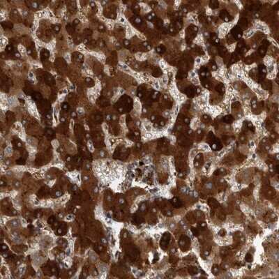 <b>Independent Antibodies Validation. </b>Immunohistochemistry-Paraffin: C-Reactive Protein/CRP Antibody [NBP1-87183] - Staining of human liver shows strong cytoplasmic positivity in hepatocytes.