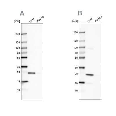 Western Blot: C-Reactive Protein/CRP Antibody [NBP1-87183] - Analysis using Anti-CRP antibody NBP1-87183 (A) shows similar pattern to independent antibody NBP1-87184 (B).