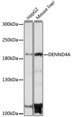 Western Blot: C-myc promoter-binding protein Antibody [NBP2-92291] - Analysis of extracts of various cell lines, using C-myc promoter-binding protein at 1:1000 dilution.Secondary antibody: HRP Goat Anti-Rabbit IgG (H+L) at 1:10000 dilution.Lysates/proteins: 25ug per lane.Blocking buffer: 3% nonfat dry milk in TBST.Detection: ECL Basic Kit .Exposure time: 30s.