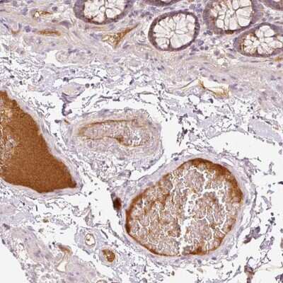 Immunohistochemistry-Paraffin: C1 inhibitor Antibody [NBP2-33536] - Staining of human colon shows strong positivity in plasma.
