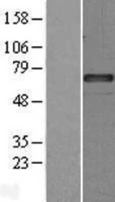 Western Blot: C1 inhibitor Overexpression Lysate (Adult Normal) [NBL1-15855] Left-Empty vector transfected control cell lysate (HEK293 cell lysate); Right -Over-expression Lysate for C1 inhibitor.