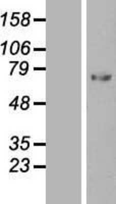 Western Blot: C1 inhibitor Overexpression Lysate (Adult Normal) [NBL1-15856] Left-Empty vector transfected control cell lysate (HEK293 cell lysate); Right -Over-expression Lysate for C1 inhibitor.