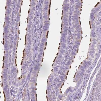 Immunohistochemistry-Paraffin CABCOCO1 Antibody