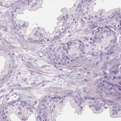 Immunohistochemistry-Paraffin CABCOCO1 Antibody