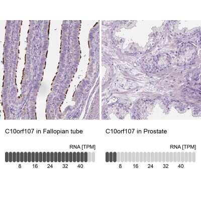 Immunohistochemistry-Paraffin CABCOCO1 Antibody