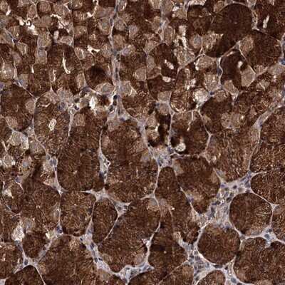 Immunohistochemistry-Paraffin: LCoR Antibody [NBP1-85075] - Staining of human stomach shows strong cytoplasmic positivity in glandular cells.