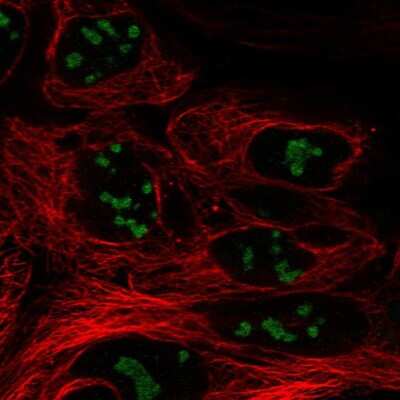 Immunocytochemistry/Immunofluorescence: C10orf131 Antibody [NBP2-58030] - Staining of human cell line CACO-2 shows localization to nucleoli.