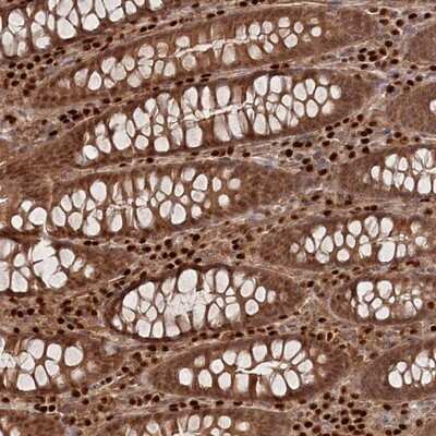 Immunohistochemistry-Paraffin: BORCS7 Antibody [NBP1-81912] - Staining of human colon shows moderate cytoplasmic and nuclear positivity in glandular cells.