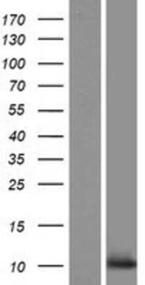 Western Blot: C10orf53 Overexpression Lysate (Adult Normal) [NBP2-08365] Left-Empty vector transfected control cell lysate (HEK293 cell lysate); Right -Over-expression Lysate for C10orf53.
