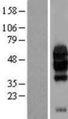 Western Blot VISTA/B7-H5/PD-1H Overexpression Lysate