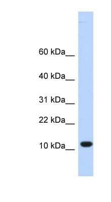 Western Blot: C10orf57 Antibody [NBP1-62316] - Titration: 0.2-1 ug/ml, Positive Control: Hela cell lysate.