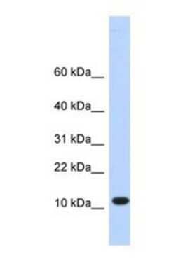 Western Blot: C10orf57 Antibody [NBP1-69342] - This Anti-C10orf57 antibody was used in Western Blot of Hela tissue lysate at a concentration of 1ug/ml.