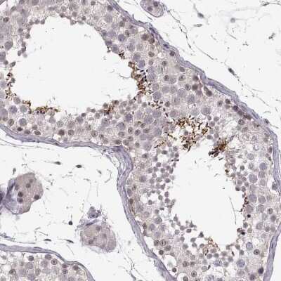 Immunohistochemistry-Paraffin: C10orf62 Antibody [NBP2-57437] - Staining of human testis shows high expression.