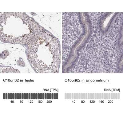 Immunohistochemistry-Paraffin: C10orf62 Antibody [NBP2-57437] - Staining in human testis and endometrium tissues using anti-C10orf62 antibody. Corresponding C10orf62 RNA-seq data are presented for the same tissues.
