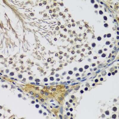 Immunohistochemistry-Paraffin: C10orf62 Antibody [NBP3-04546] - Paraffin-embedded rat testis using C10orf62 antibody at dilution of 1:100 (40x lens).